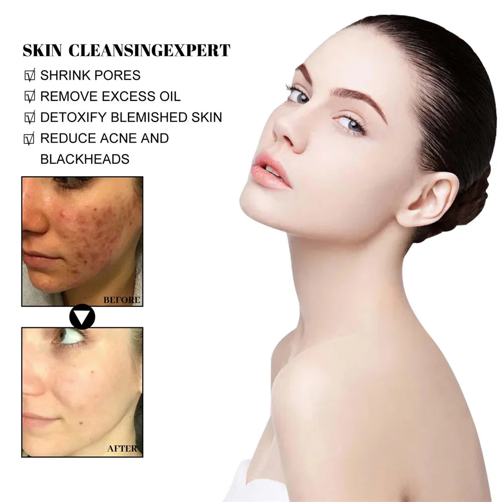 West & Month Mascarilla Facial de Barro Sólido para Eliminar Puntos Negros: Refresca, Limpia, Hidrata, Controla la Grasa y Reduce Poros (Poros Prohibidos)