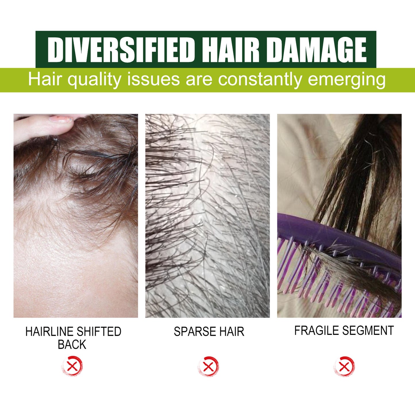 Acondicionador de Aceite de Batana Eelhoe: Repara el cabello dañado, hidrata y suaviza el cabello.(Suavidad Irresistible)