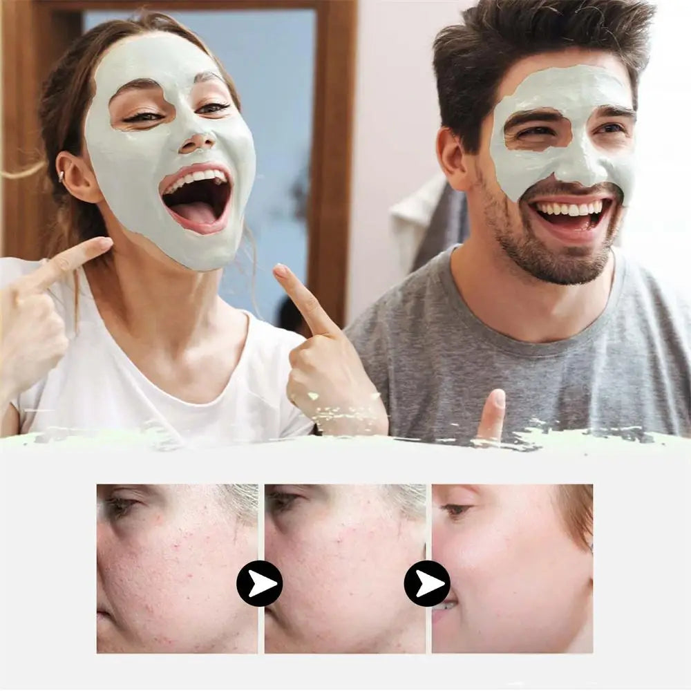 West & Month Mascarilla Facial de Barro Sólido para Eliminar Puntos Negros: Refresca, Limpia, Hidrata, Controla la Grasa y Reduce Poros (Poros Prohibidos)