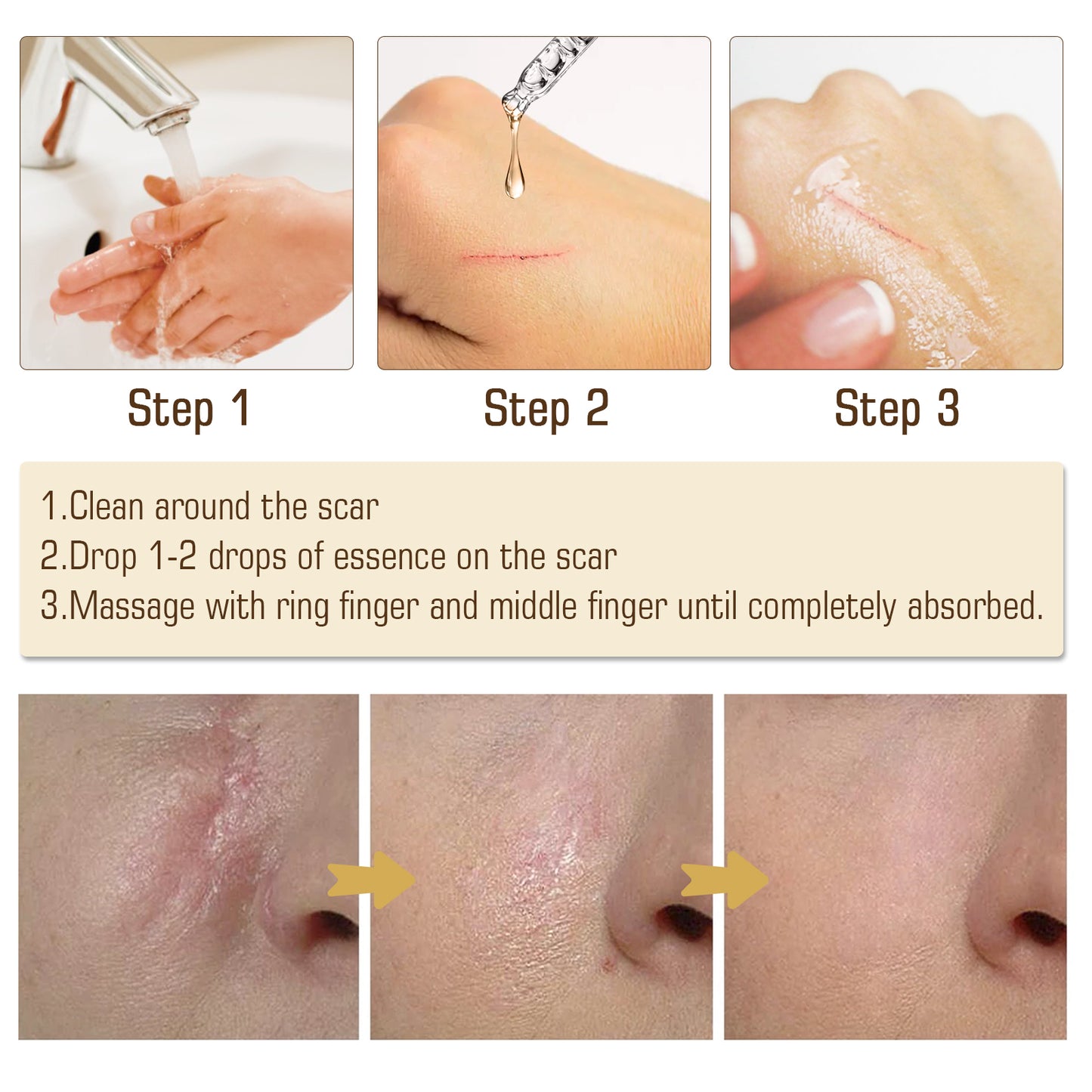 Jaysuing Scar Essential Oil, Reduces Scars Remove Burn Marks Repair Smooth Skin Essential Oil
