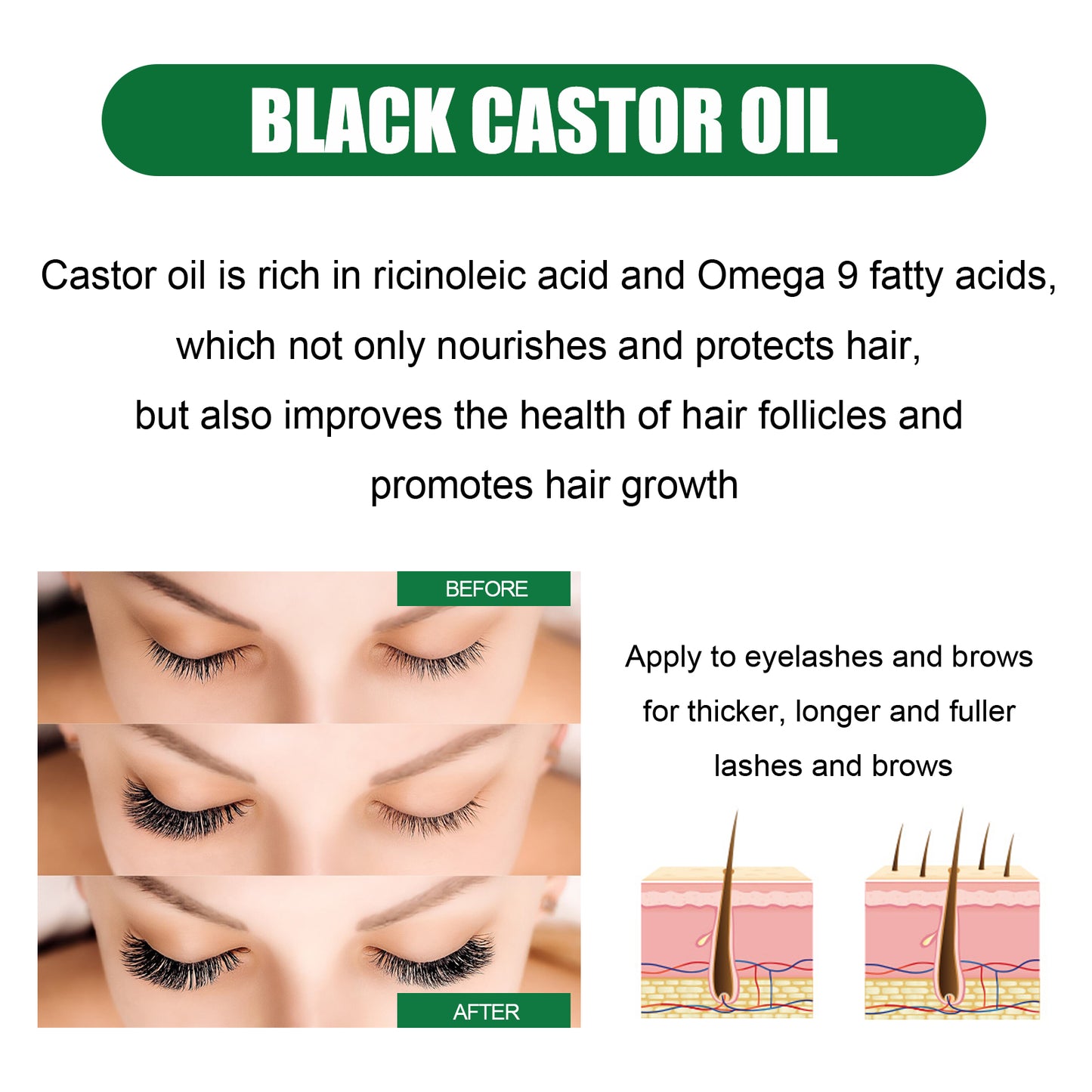 Acondicionador Capilar de Aceite de Ricino OUHOE: Nutre las raíces del cabello, suaviza el cabello y previene la caída.(Brillo Íntimo)