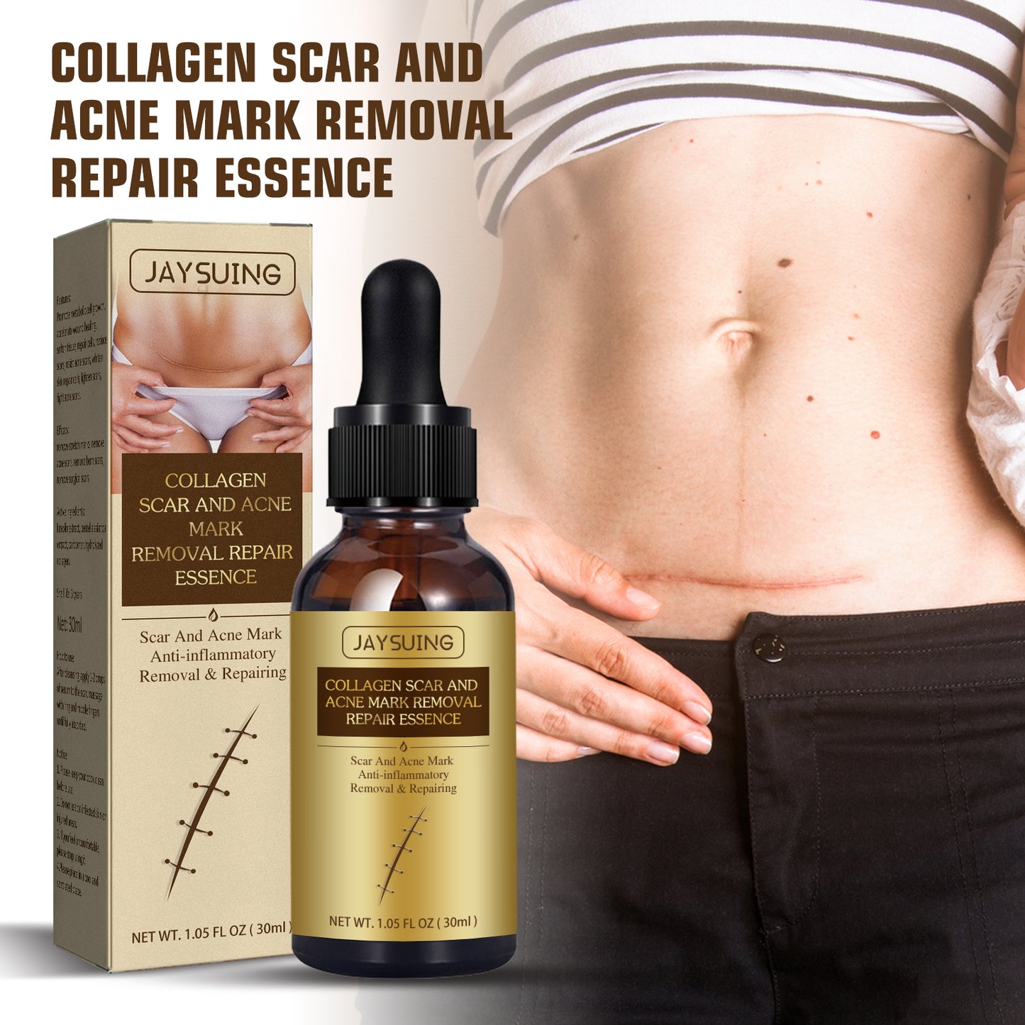 Jaysuing Scar Essential Oil, Reduces Scars Remove Burn Marks Repair Smooth Skin Essential Oil