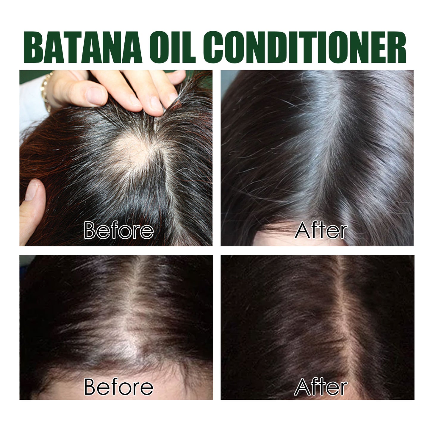 Acondicionador de Aceite de Batana Eelhoe: Repara el cabello dañado, hidrata y suaviza el cabello.(Suavidad Irresistible)