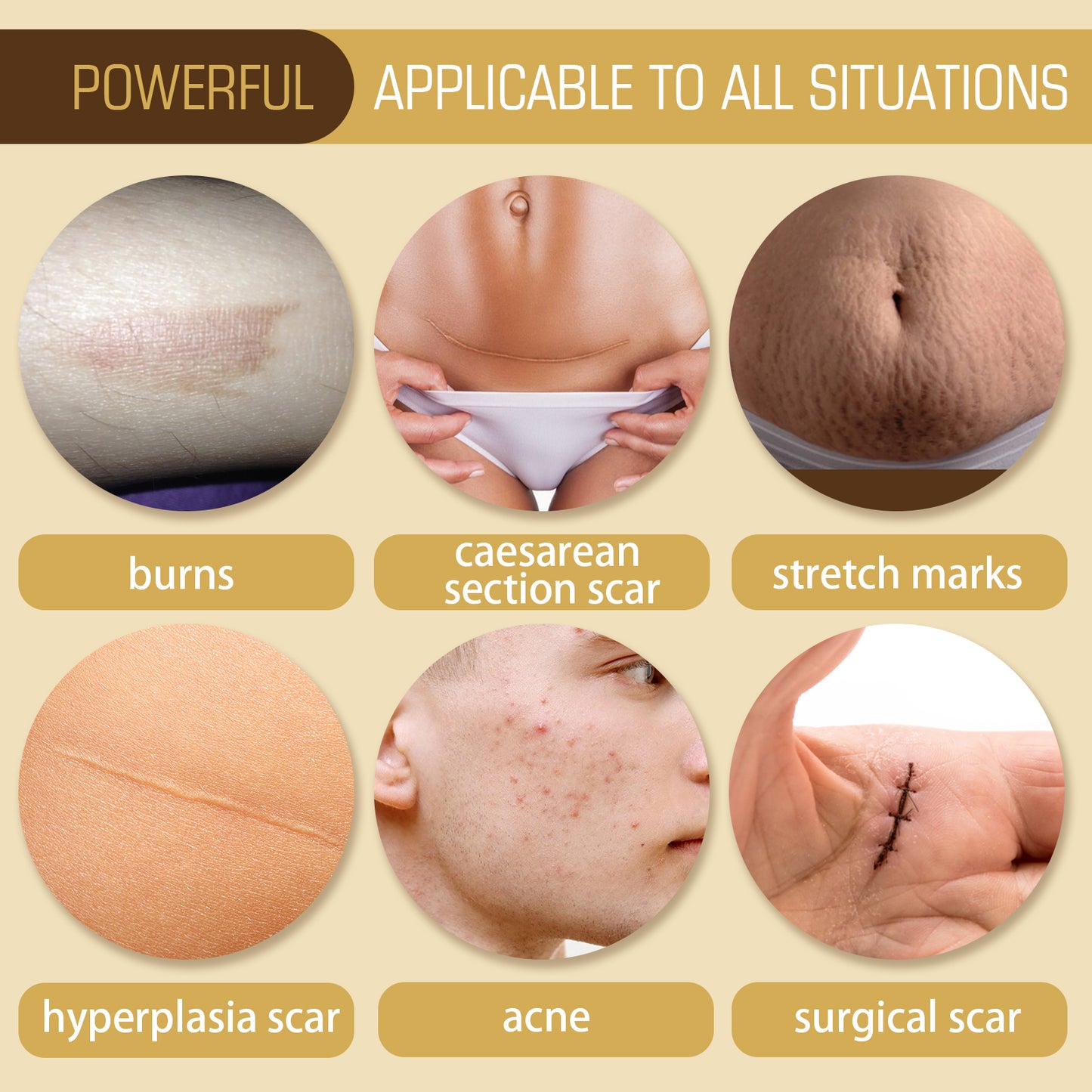Jaysuing Scar Essential Oil, Reduces Scars Remove Burn Marks Repair Smooth Skin Essential Oil