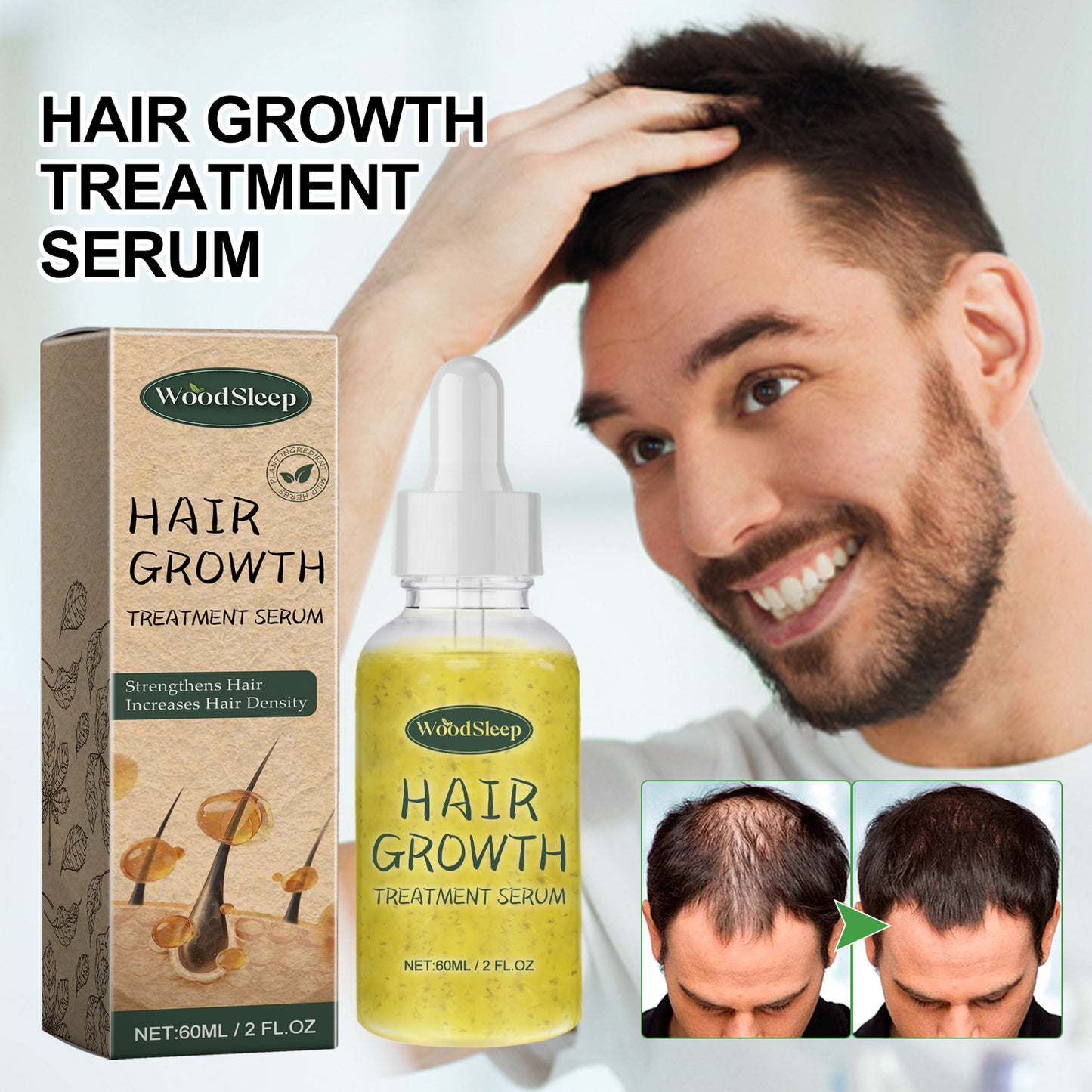 WoodSleep Hair Care Essential Oil For Damaged Hair Strengthens, Strengthens, Nourishes, Roots And Thickens Hairline Essential Oil