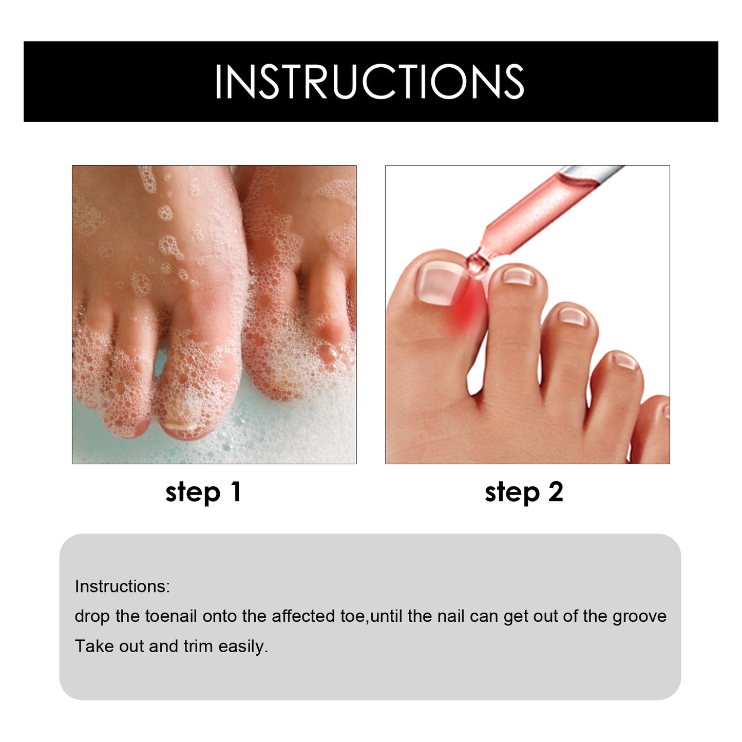 South Moon Toenail Repair Essence (30ml) Moisturizes, Repairs And Cleanses Foot Nails, Brightening Nail Care Essential Oil