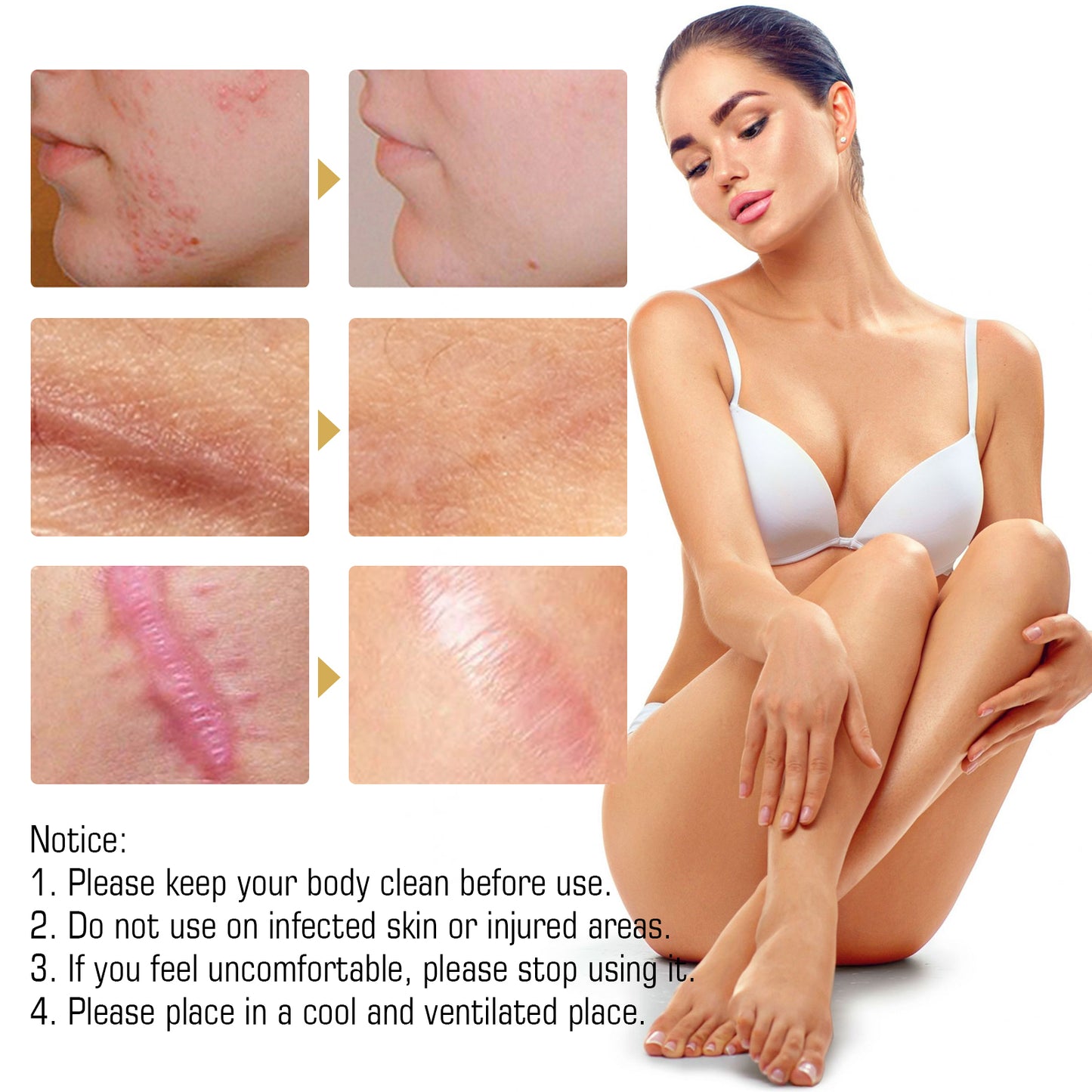 Jaysuing Scar Essential Oil, Reduces Scars Remove Burn Marks Repair Smooth Skin Essential Oil